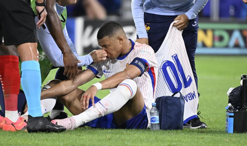 Euro: Mbappe, Le Nez Qui Fait Trembler La France